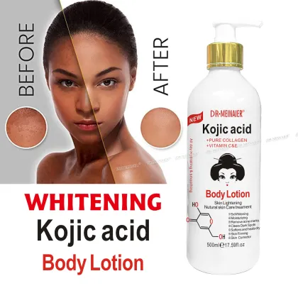 Kojic Acid Body Lotion for Moisturizing and Beauty