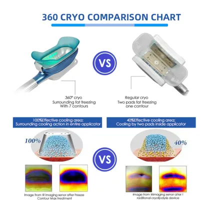 Fat lipolysis freeze body sculpting machine