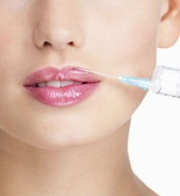 hyaluronic acid Lip augmentation injection