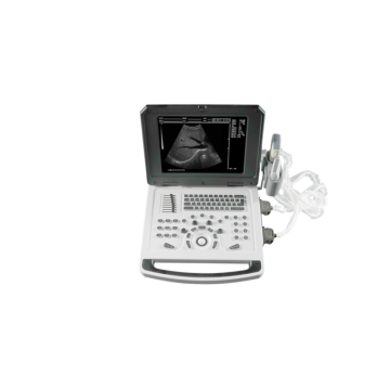 Notebook Color Doppler Ultrasound Machine for Small Organ