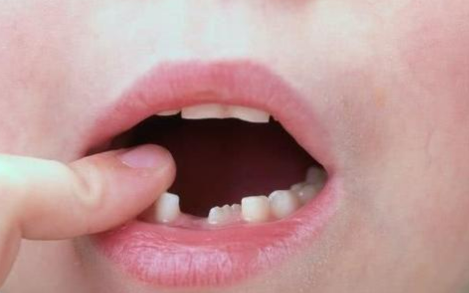 marigold extract for teething