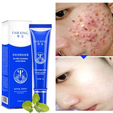 Practical 15g acne blackhead acne cream with oil control shrink pores for acne removal scar whitening and facial treatment