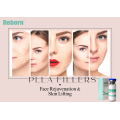 Reborn Plla Fillers for Temple Plump