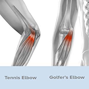 golfers/tennis elbow