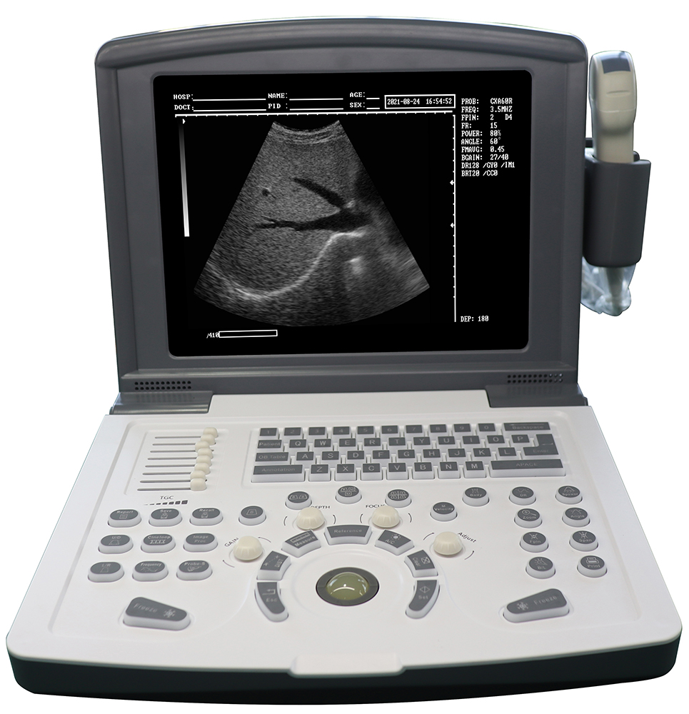 Tragbarer B/W-Diagnose-Ultraschallscanner (eingebauter Akku)