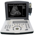 Bärbar b/w diagnostisk ultraljudsscanner (inbyggt batteri)