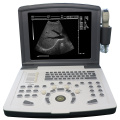 Human Ultrasound Scanner MDK-660D Portable B-ultrasound Scanner(Built-in battery) Factory