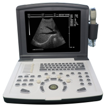 Портативный B/W Диагностический ультразвуковой сканер (встроенный батарея)