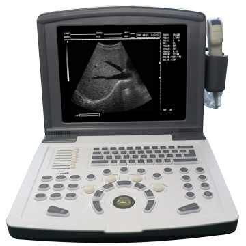 Portable B/W Diagnostic Ultrasound scanner(Built-in battery)