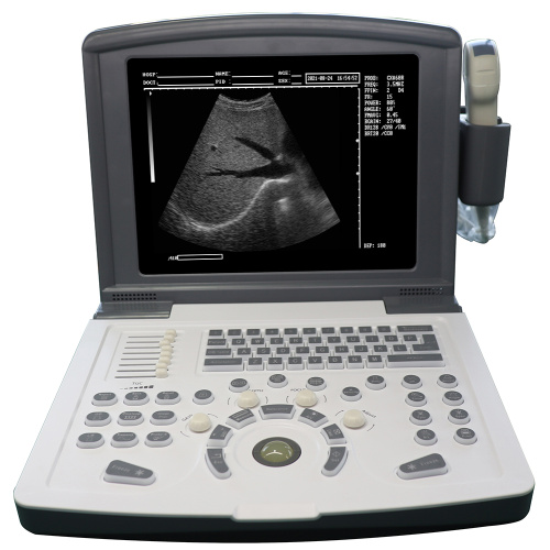 Animal Ultrasound Scanner Portable B/W Diagnostic Ultrasound scanner(Built-in battery) Factory