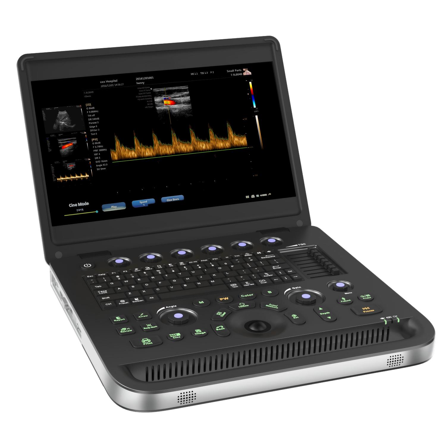 Кошт ультрагукавога машыны для колеру color doppler ultrasound machine price