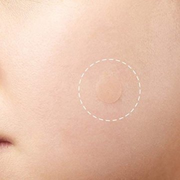 Acne Pimple Patch Ospirò idrocolloide monolocale acne Pimple Patch