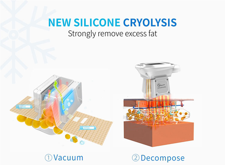 Cryo Cooling Rf Slimming Device