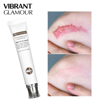 High Quality Crocodile Repair Gel: Scar Removal & Skin Care Cream