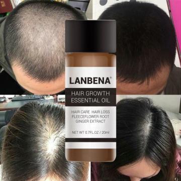 2020 NEW Hair Growth Essence Anti-Hair-Loss Essential Oil Liquid 20ml Treatment Repair Hair Serum Hair Loss Product TSLM2
