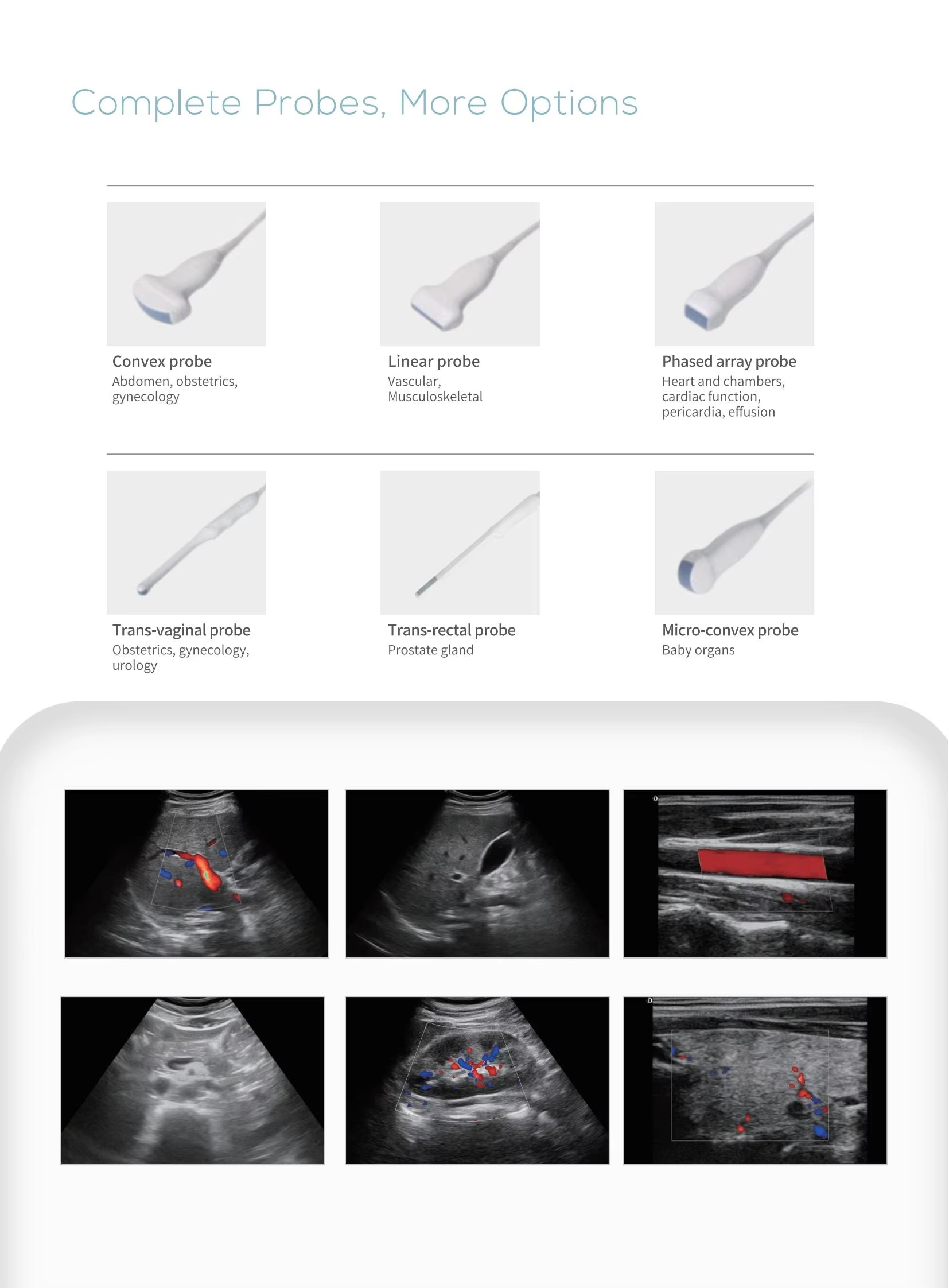 Trolley Color Doppler Ultrasound Scanner