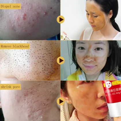 Private label wholesale pore peel off mask pigmentation correctors blackhead remover mask