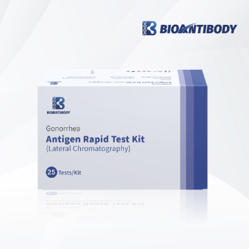 Kit d'essai rapide de l'antigène de la gonorrhée (chromatographie latérale)
