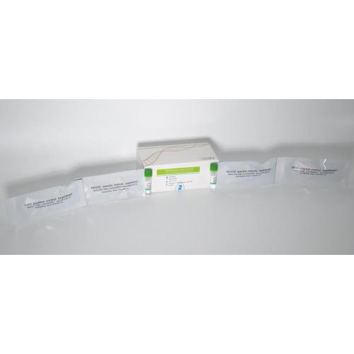 Kit de teste de ácido nucleico do RSV (método da sonda de pCR-fluorescência)