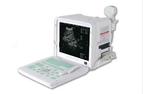 Latest fetal full digital Ultrasound machine