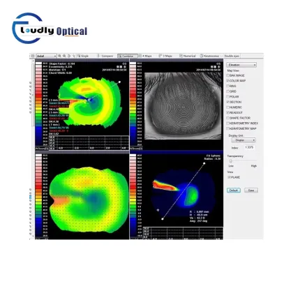 SW-6000 Corneal Topographer - High Quality Ophthalmic Equipment