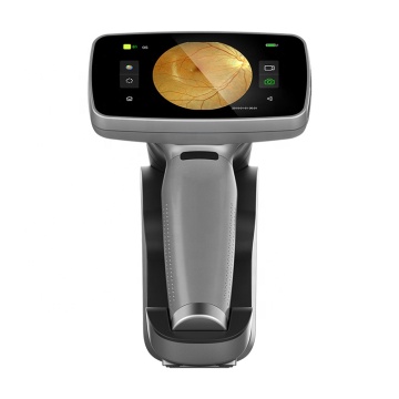 Auto Portable Hand-held Retinal Fundus Camera - SHTOPVIEW HFC-2