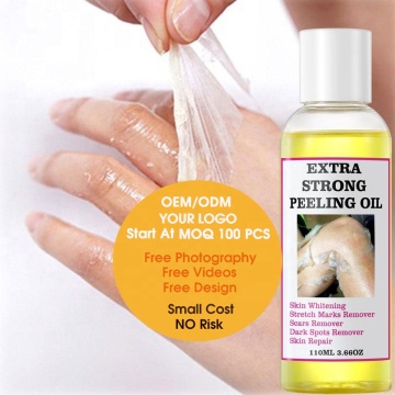 Private Label Dark Knuckles Skin Peeling Solution - Extra Strength Whitening