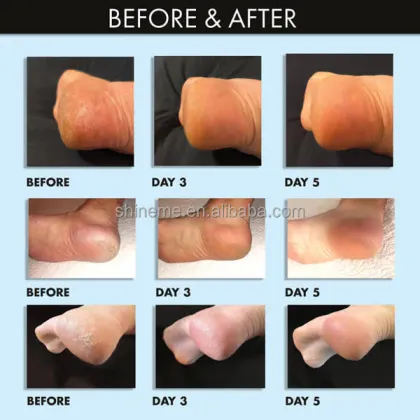 Natural Coconut Milk Foot Cream - Deep Moisturizing & Exfoliating Peeling Mask