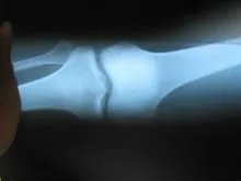 konida medical dry film, film sex china with x ray machine konica film