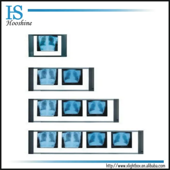 slim X-Ray film viewer