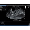 Партатыўны партатыўны ультрагукавой сканер KPC-5C Convex Color Doppler