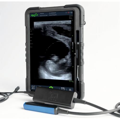 Fast Scan L ultrasound cows for pregnancy
