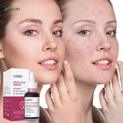Private Label Fruit Acid Essence for Pore Shrinking and Skin Brightening