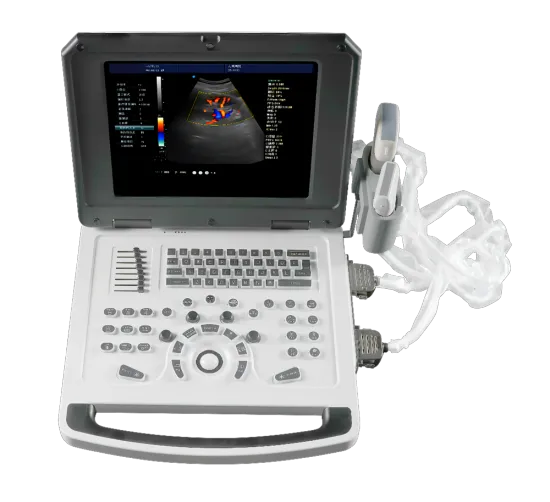 Notebook doppler ultrasonic machine for medical instrument
