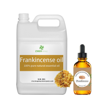 اسانس طبیعی Frankincense برای مراقبت از پوست و مو