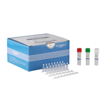 Gefriergetrocknete Zeitpcr-Kit für neuartige Coronavirus 2019-NCOV (ORF1AB, N, E)