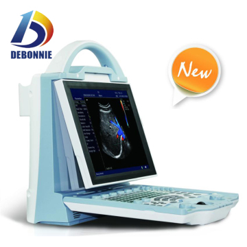 Full Digital 2D Color Doppler Ultrasound Scanner with CE