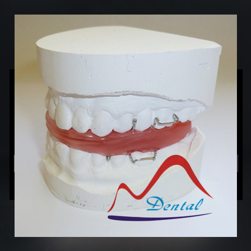 Frankel orthodontic dental Appliance 1 (3)