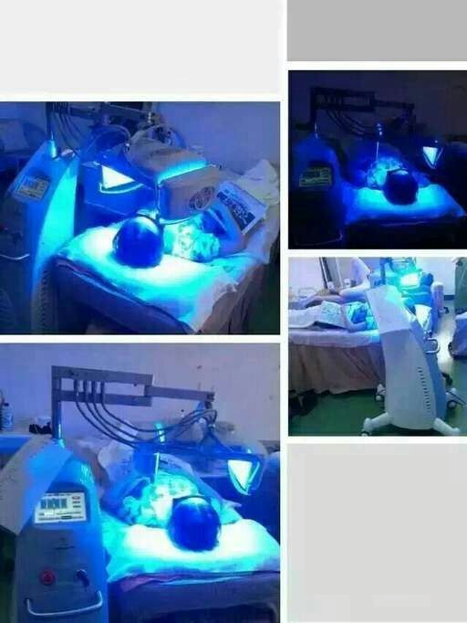 Led Blue Light Therapy