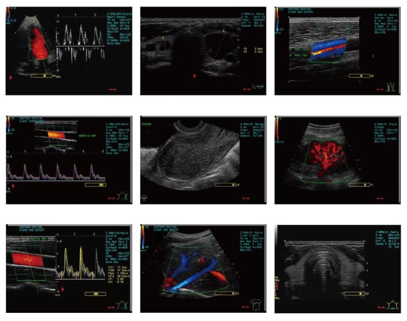 3D Fully-Digital Multi-Functional Color Doppler Ultrasound Systems with Touch-Screen