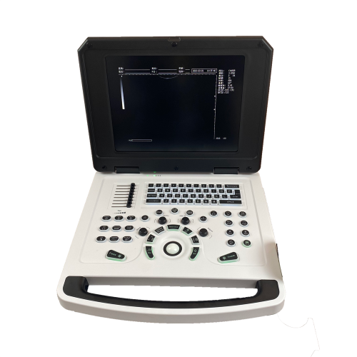 Cheap and Competitive Notebook Laptop Ultrasound Scanner