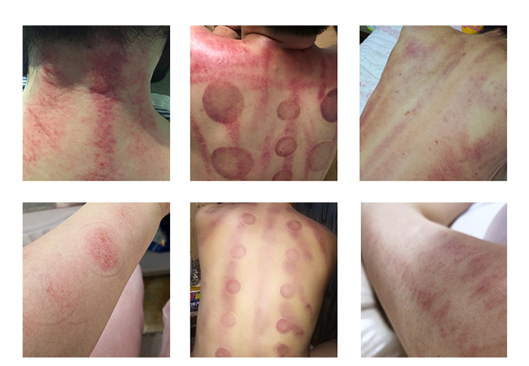 ultrasonic cavitation at home