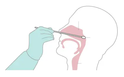 10ml bio sampling kits no preservative solution with flocking swab