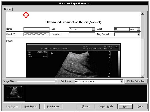 ultrasound equipment Touch Screen