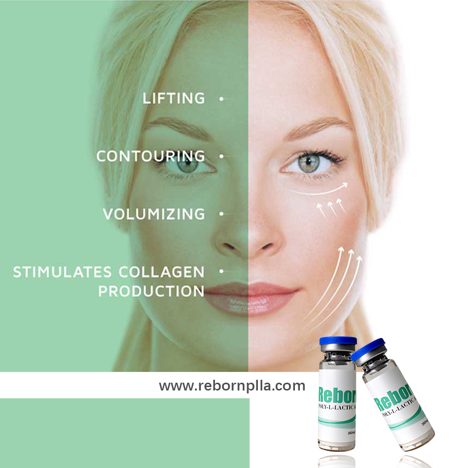 ฟิลเลอร์สำหรับการยกใบหน้า filler for face lifting