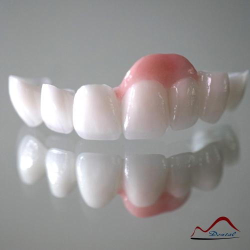 3Shape Zirconia Bridge With Gum Porcelain