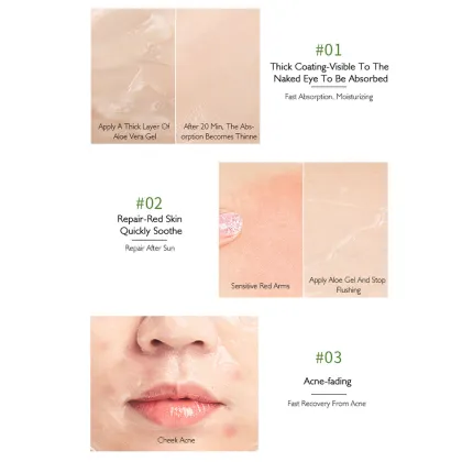 Organic Herbal Aloe Vera Gel - 99% Pure Moisturizing Skin Care