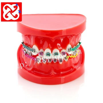 Orthodontic Treatment Demonstration: Extracted Premolar with Brackets and Ligature Wire