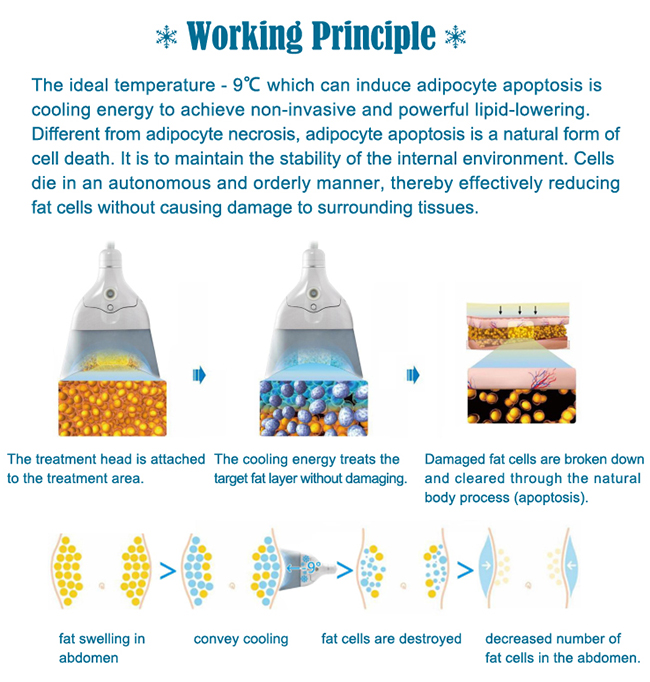 Working Principle Of Ems Body Rf Machine