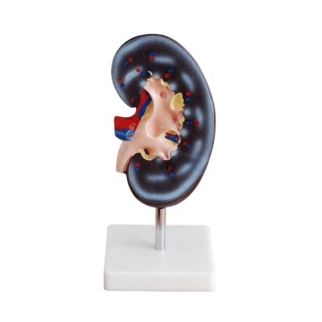 Darhmmy Medical Science Human Kidney Anatomical Modèle pour l'enseignement
